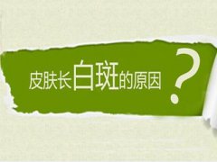 孩子得了白癜风后用药时需要注意什么?